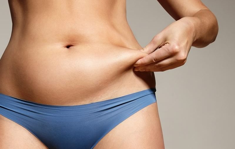 Plastie abdominale à Paris, L'opération pour lifter le ventre