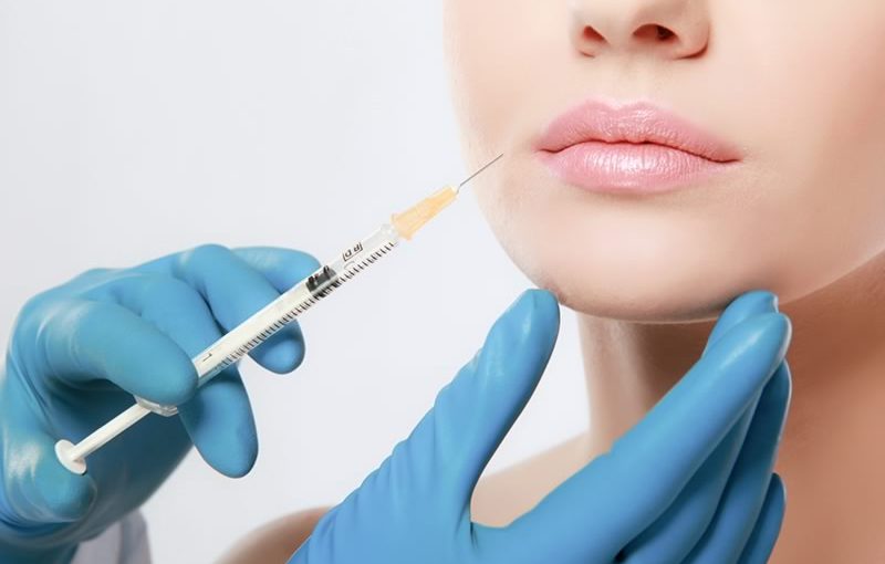 Embellissement et rajeunissement du visage par injections d’acide hyaluronique, à paris, Dr Marsili