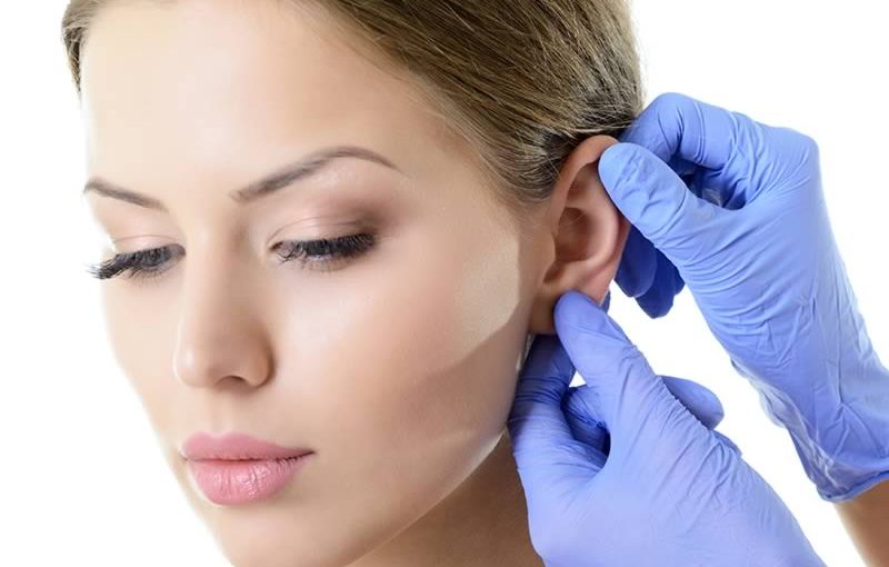 La correction des oreilles décollées par otoplastie à paris, Dr Marsili
